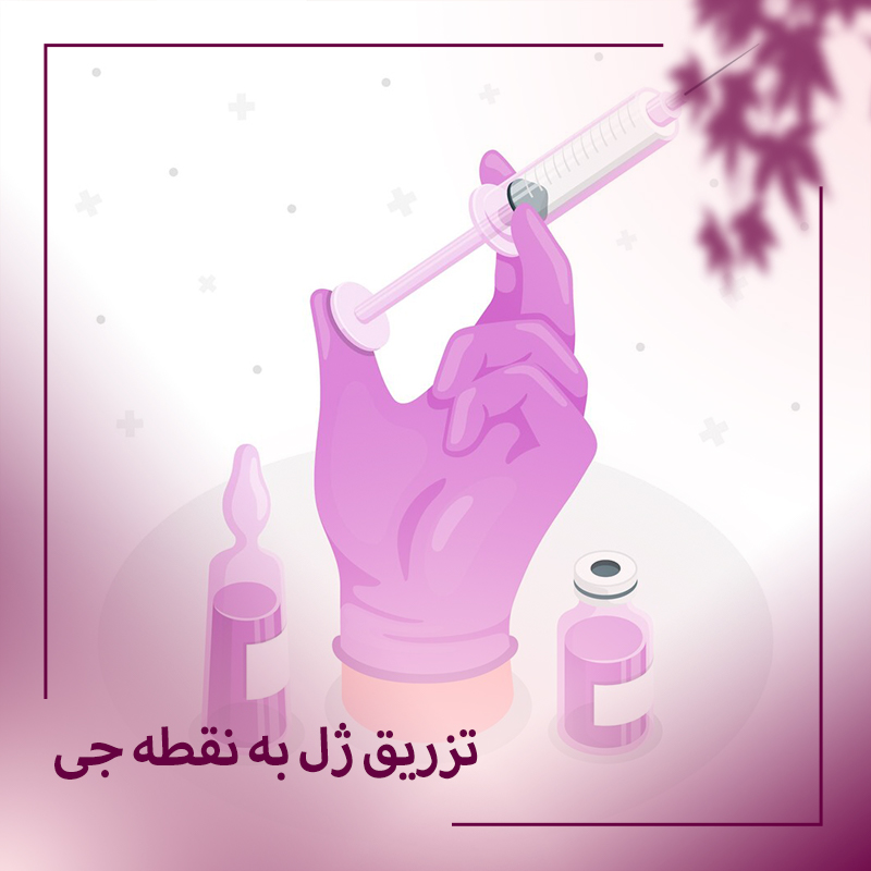 تزریق ژل به نقطه جی در بوشهر