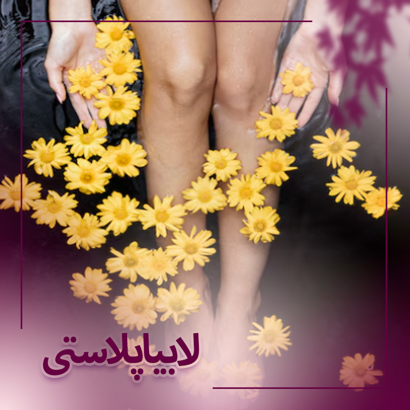 لابیاپلاستی در بوشهر